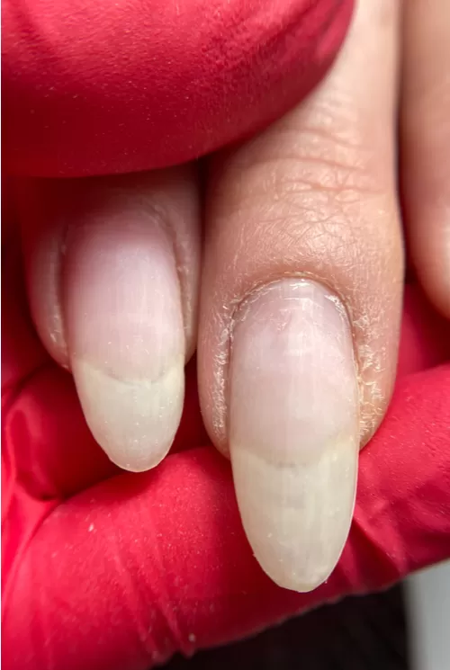 Görsel ALT Başlığı