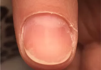 Görsel ALT Başlığı