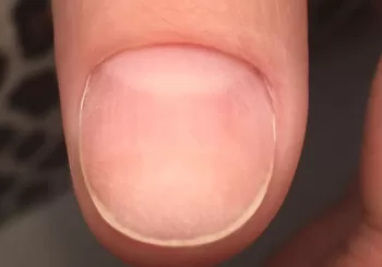 Görsel ALT Başlığı