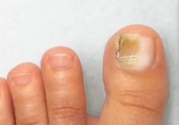 Görsel ALT Başlığı