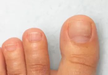 Görsel ALT Başlığı