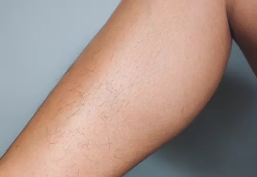 Görsel ALT Başlığı